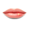 Herpes